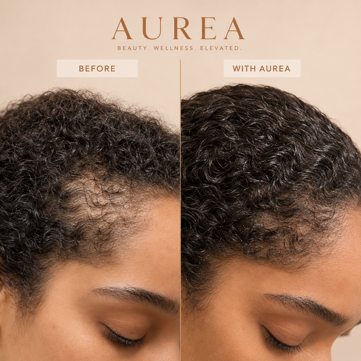 Aurea- Hair Supplement